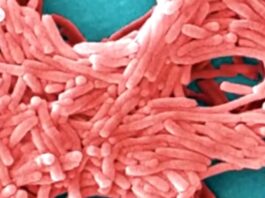 Mayor Mamdani announces new measures to combat Legionnaires’ disease Mayor Mamdani announces new measures to combat Legionnaires’ disease