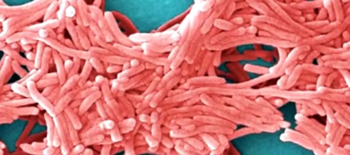 Mayor Mamdani announces new measures to combat Legionnaires’ disease